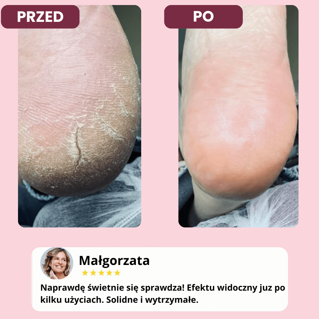 Wielorazowe Silikonowe Skarpetki Nawilżające